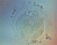 ovocito en dos pronucleos1